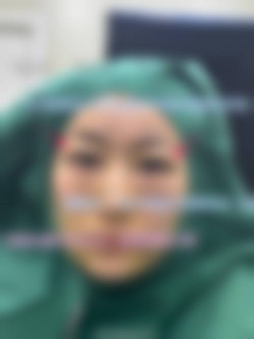 李金成医生的专精服务