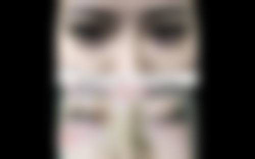 安晶玉医生的医美口碑