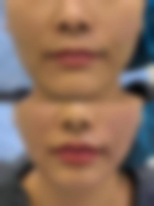 南平润微坊整形医院怎么样基本信息