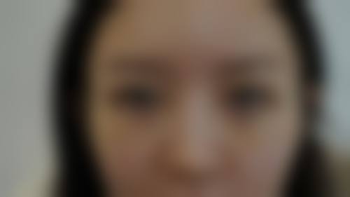 安晶玉医生擅长的医美项目