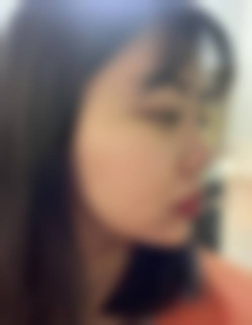 北京尚悦杰医疗美容诊所怎么样求美者反馈