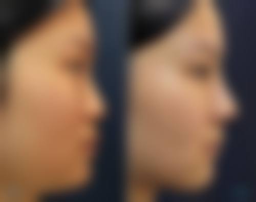 广州如花整形医院怎么样医生团队实力