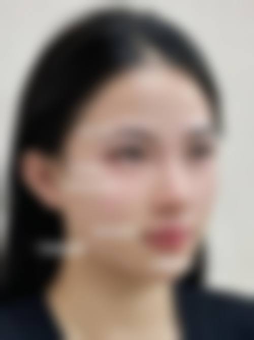 潍坊还幼整形医疗美容门诊部怎么样来院路线