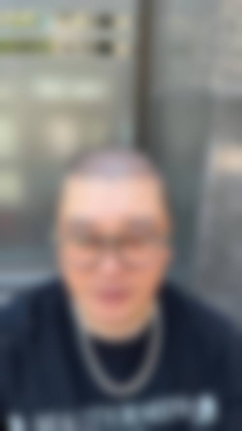 苏州新生植发怎么样价格收费