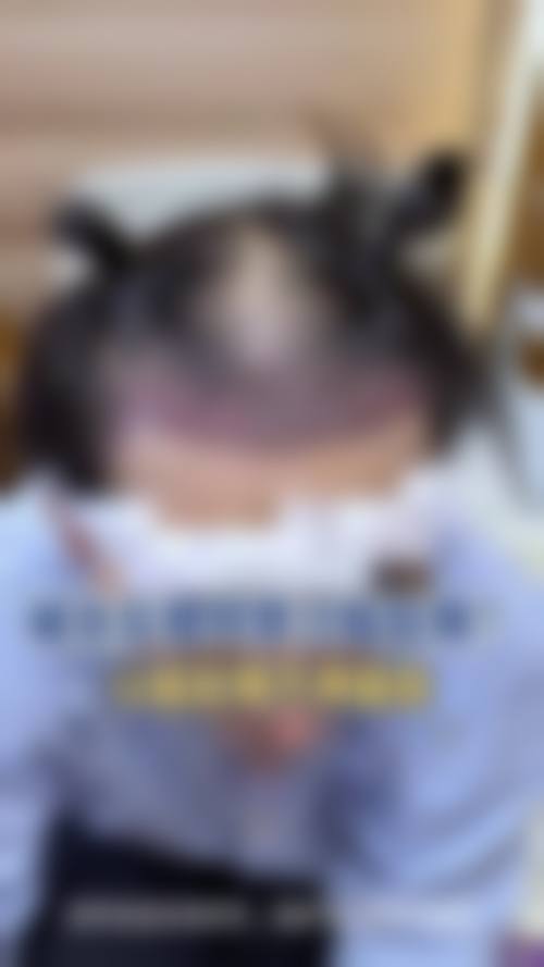 苏州新生植发怎么样特色项目及技术优势