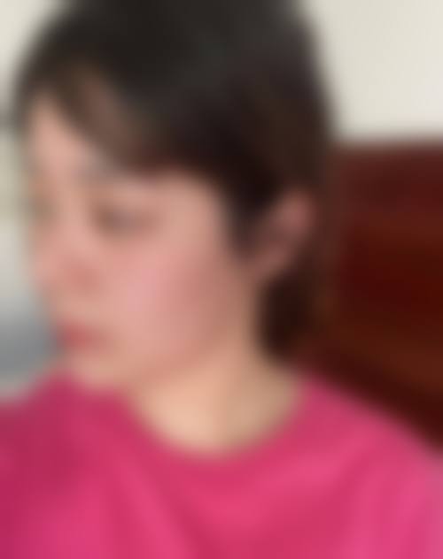 Esther Jim的医美成功实例