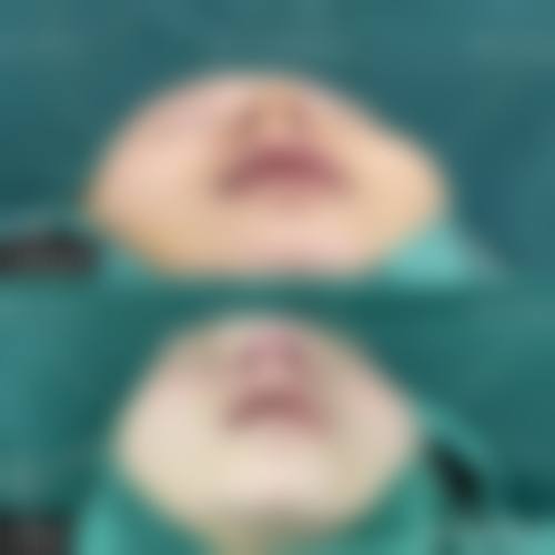 沈阳郭秀莲医疗美容诊所怎么样价格收费