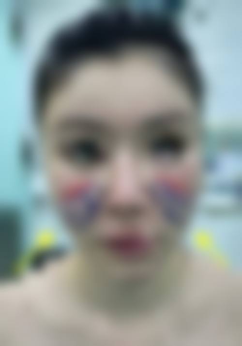 长沙思美医疗美容门诊部怎么样价格收费