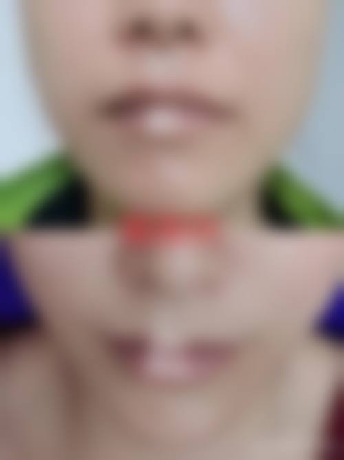 湖南长沙瑞澜医疗整形美容医院怎么样特色项目及技术优势