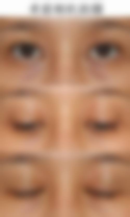 赵盛魁带来的个性化医美体验