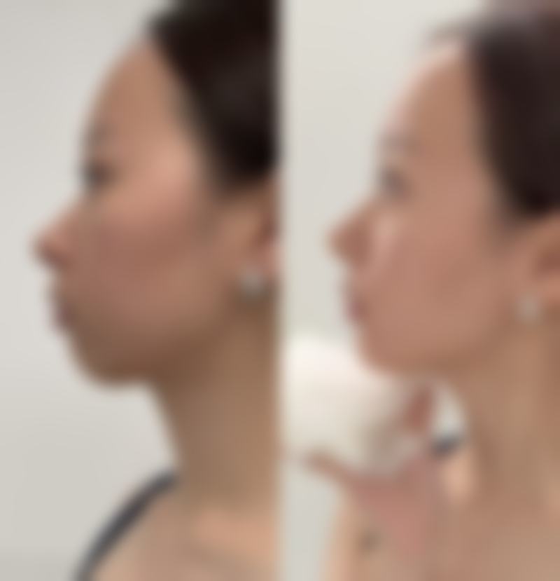 湖南长沙瑞澜医疗整形美容医院怎么样求美者反馈