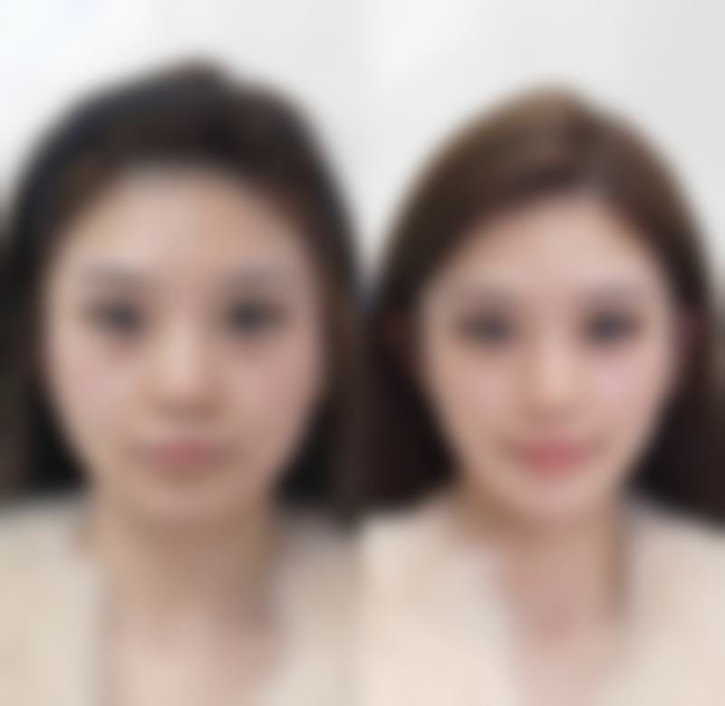 郑州天一医疗美容医院怎么样特色项目及技术优势