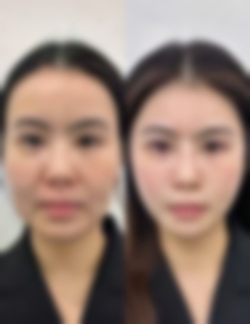 郑州天一医疗美容医院怎么样来院路线