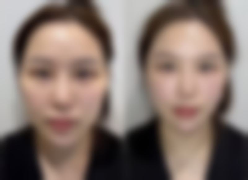 湖南长沙瑞澜医疗整形美容医院怎么样价格收费