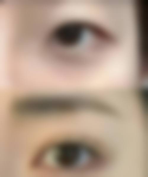 汝州溱美整形医院怎么样特色项目及技术优势