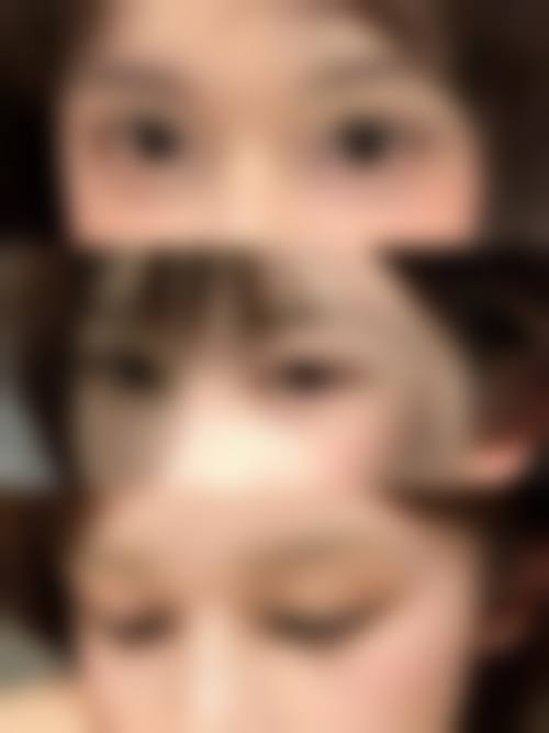 济南法熙整形医院怎么样求美者反馈