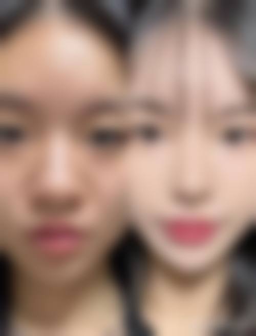 惠州市惠阳区心壹美医疗美容门诊部怎么样价格收费