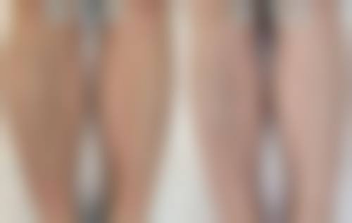 韩国swiz皮肤科怎么样求美者反馈