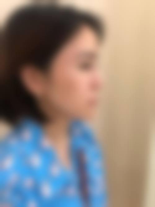 陈德洲医生的特色技术