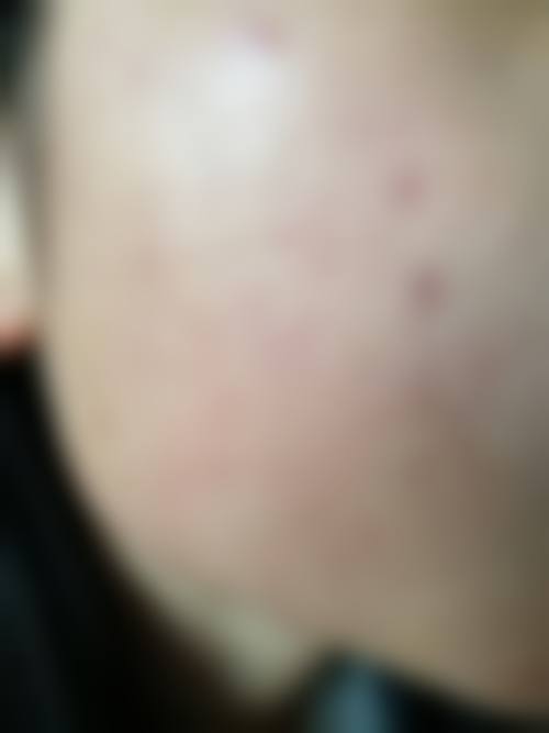 张玉洁擅长的医美项目大揭秘