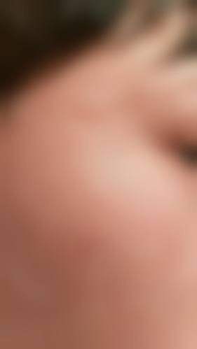 张玉洁的医美技术优势