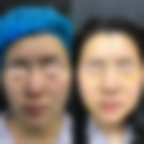 郑妍丽医生的技术优势