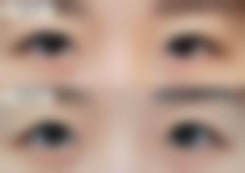 金正一擅长的整形领域