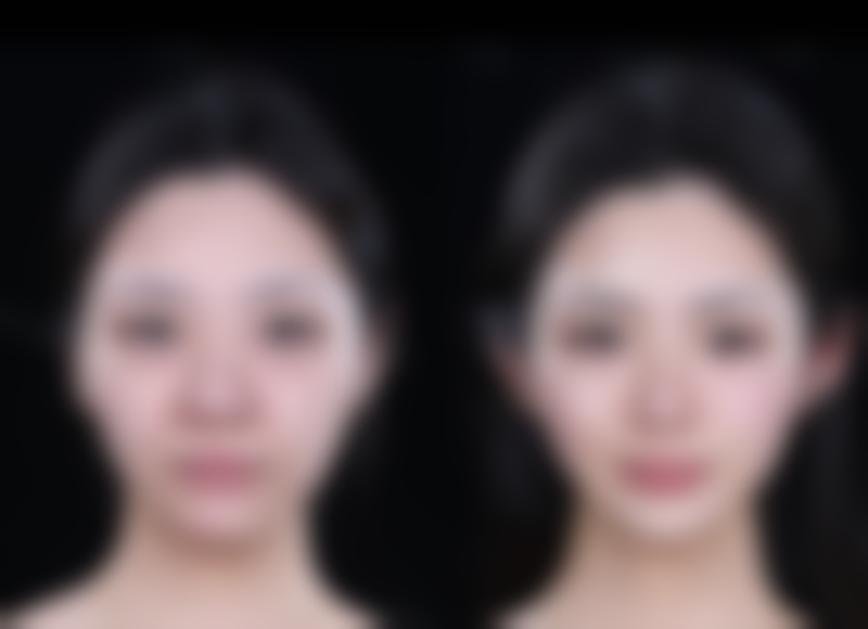 长春枫芸恩喜整形医院怎么样特色项目及技术优势