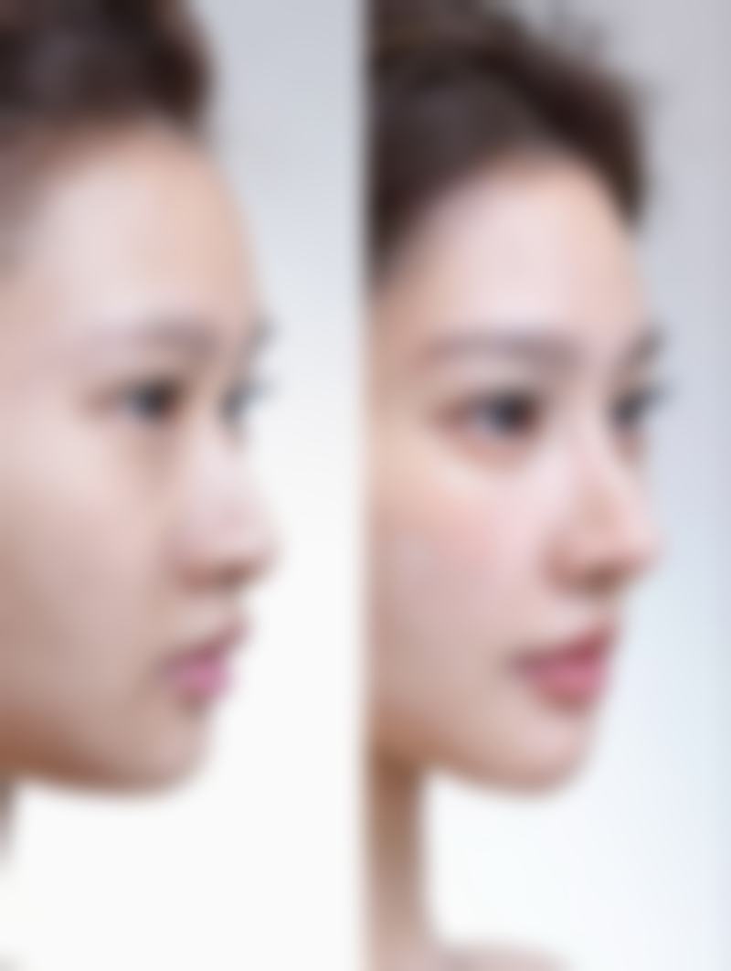 杭州千晴医疗美容医院怎么样简介概述