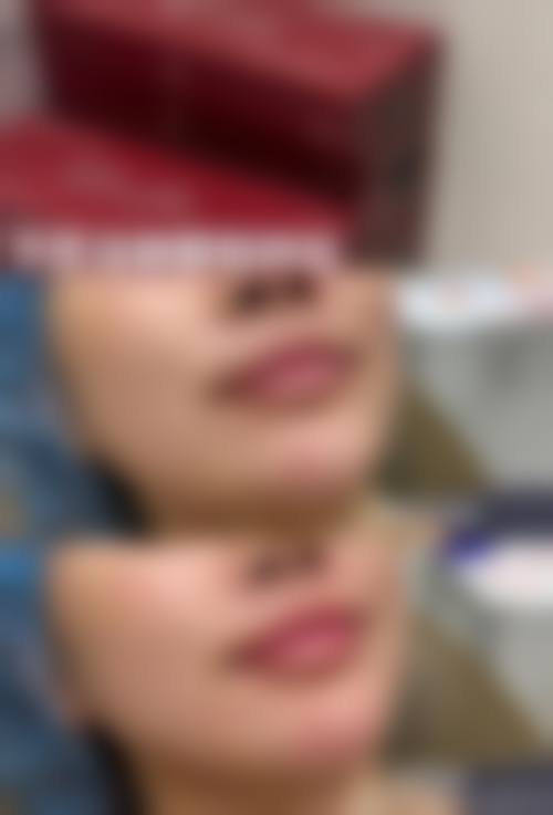 河北邢台沙河伊嘉医疗美容怎么样求美者反馈