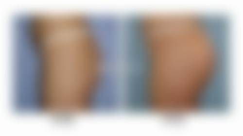 大庆市第五医院(医疗美容专科)怎么样医生团队实力