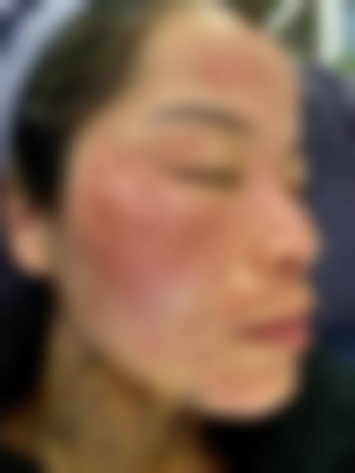 泰州丽臻医疗美容诊所怎么样特色项目及技术优势