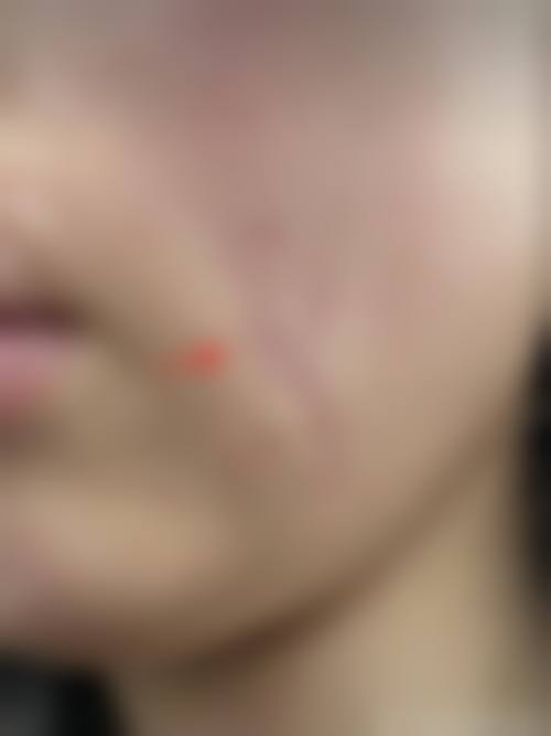 绵阳韩美整形医院怎么样求美者反馈