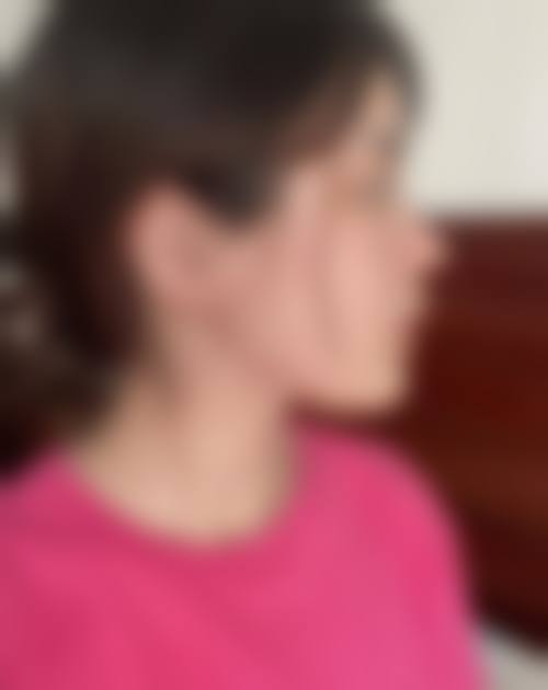 南京维美锶整形医院怎么样特色项目及技术优势