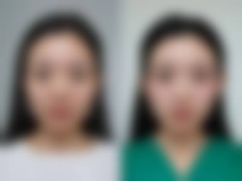 哈尔滨宋明亮整形医院怎么样来院路线