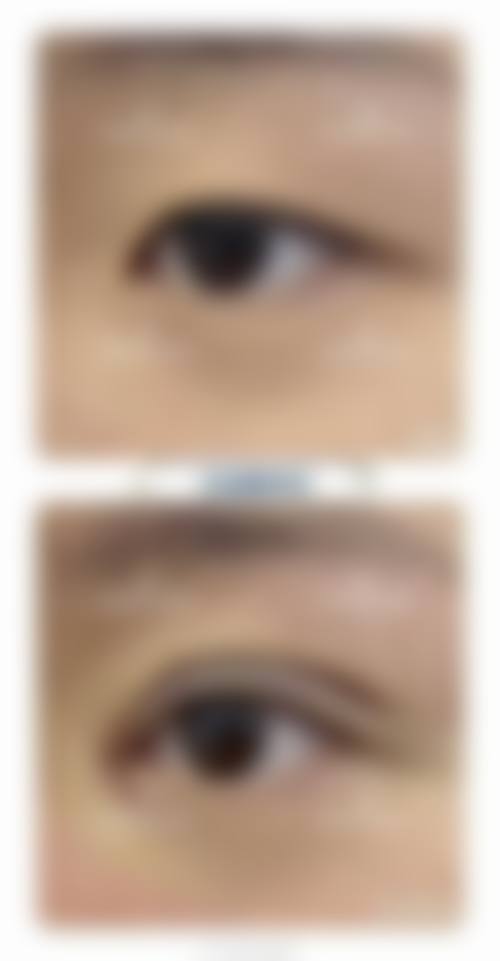 泰州丽臻医疗美容诊所怎么样来院路线