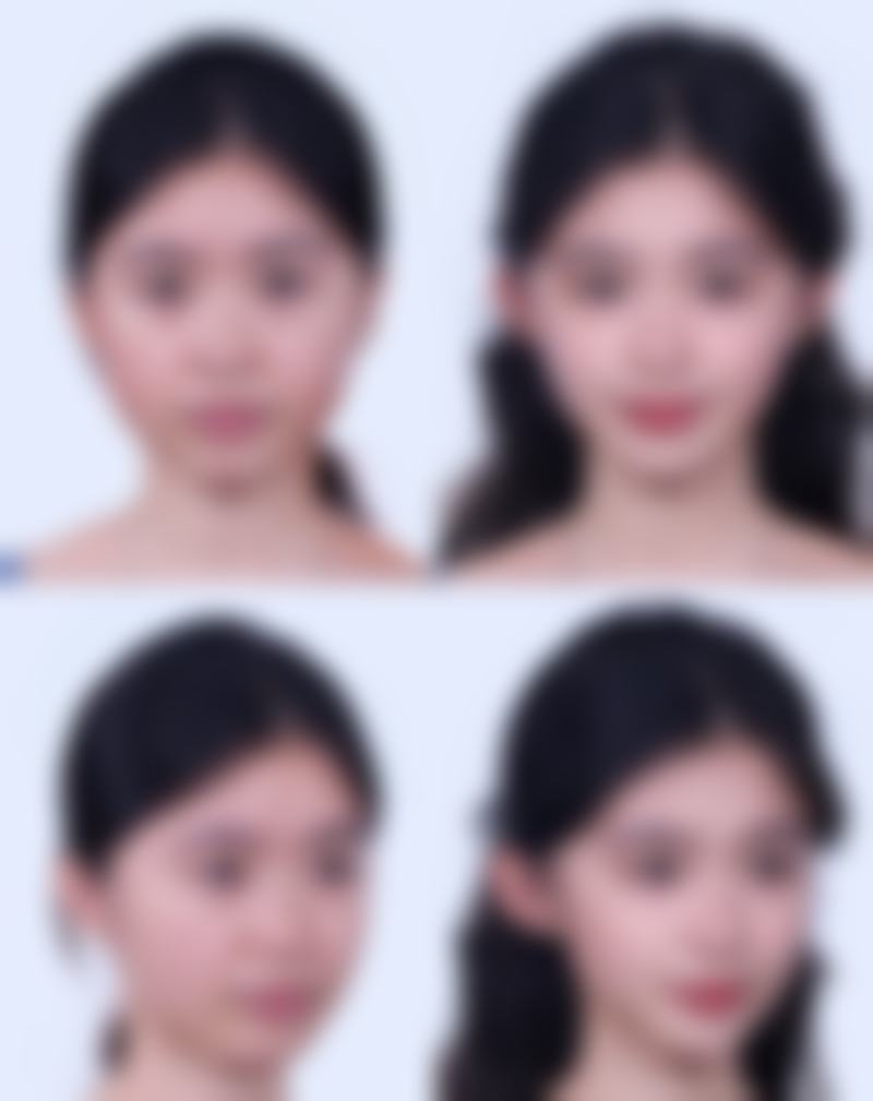 成都中科瑞美整形医院怎么样价格收费