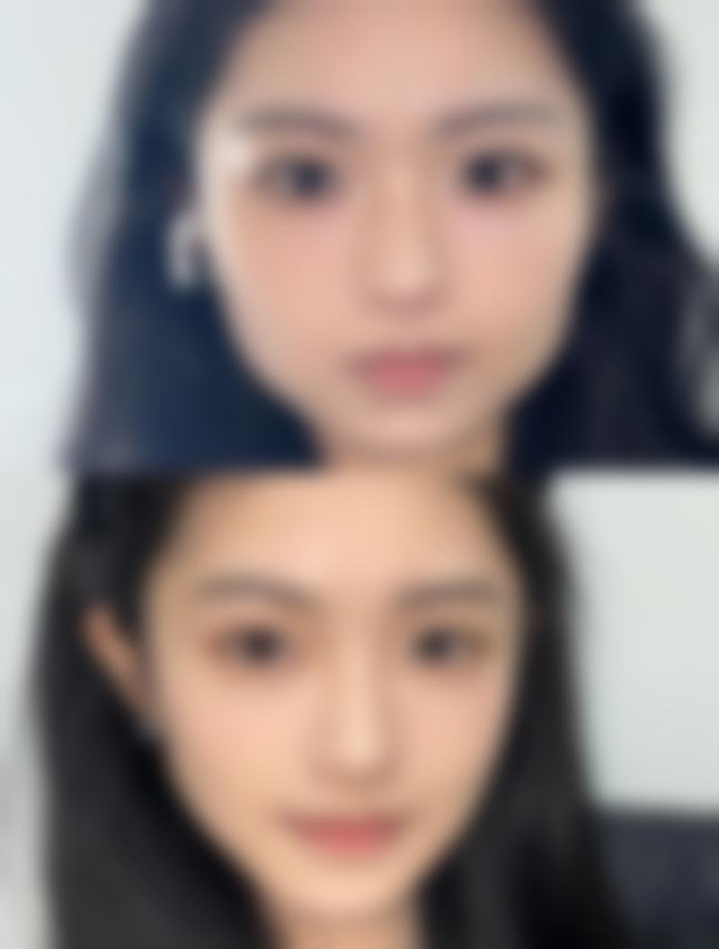 成都中科瑞美整形医院怎么样特色项目及技术优势