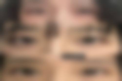 李君医生：精良技术的应用者