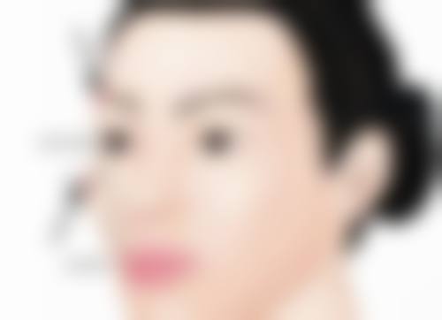 深圳新生植发医院怎么样简介概述