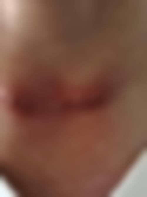 孔应超医生值得信赖