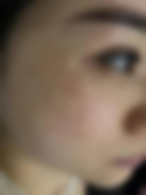 孔应超医生带来的价格优势