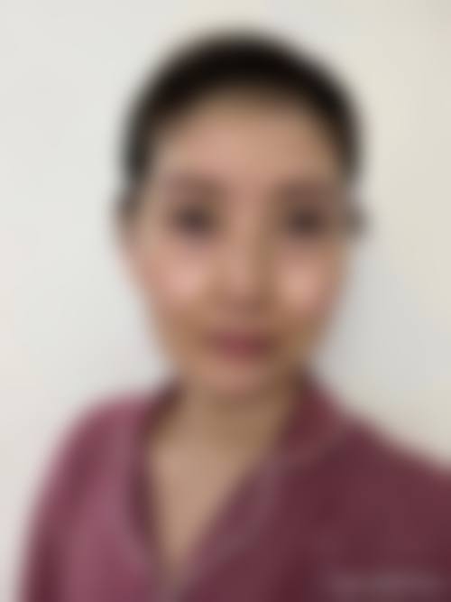 富来慕医疗美容整形医院怎么样求美者反馈