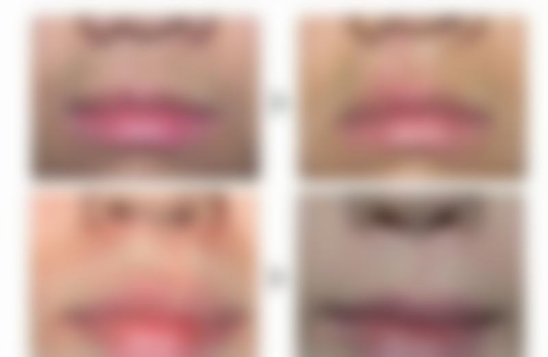 泉州儿童医院整形美容外科怎么样医生团队实力