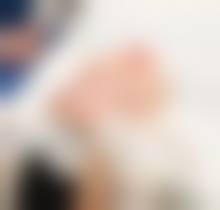 李君医生的价格优势