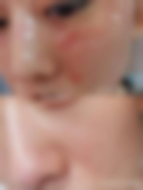 李君医生的精良技术依托