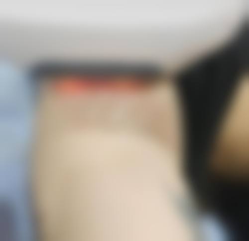 池上波斯菊皮肤科怎么样来院路线