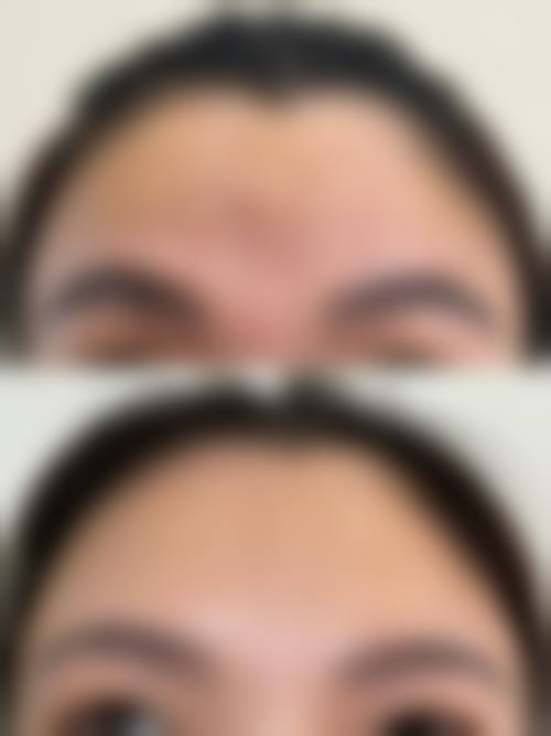 无锡同济医疗美容门诊部怎么样价格收费