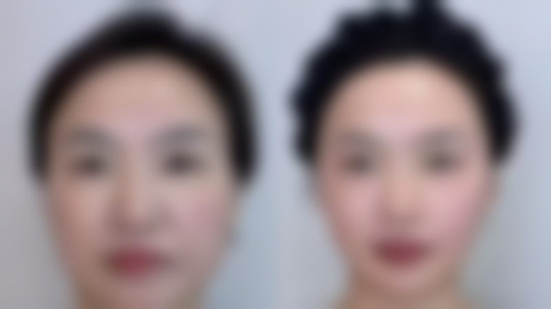 杨雪理医生的成功实例