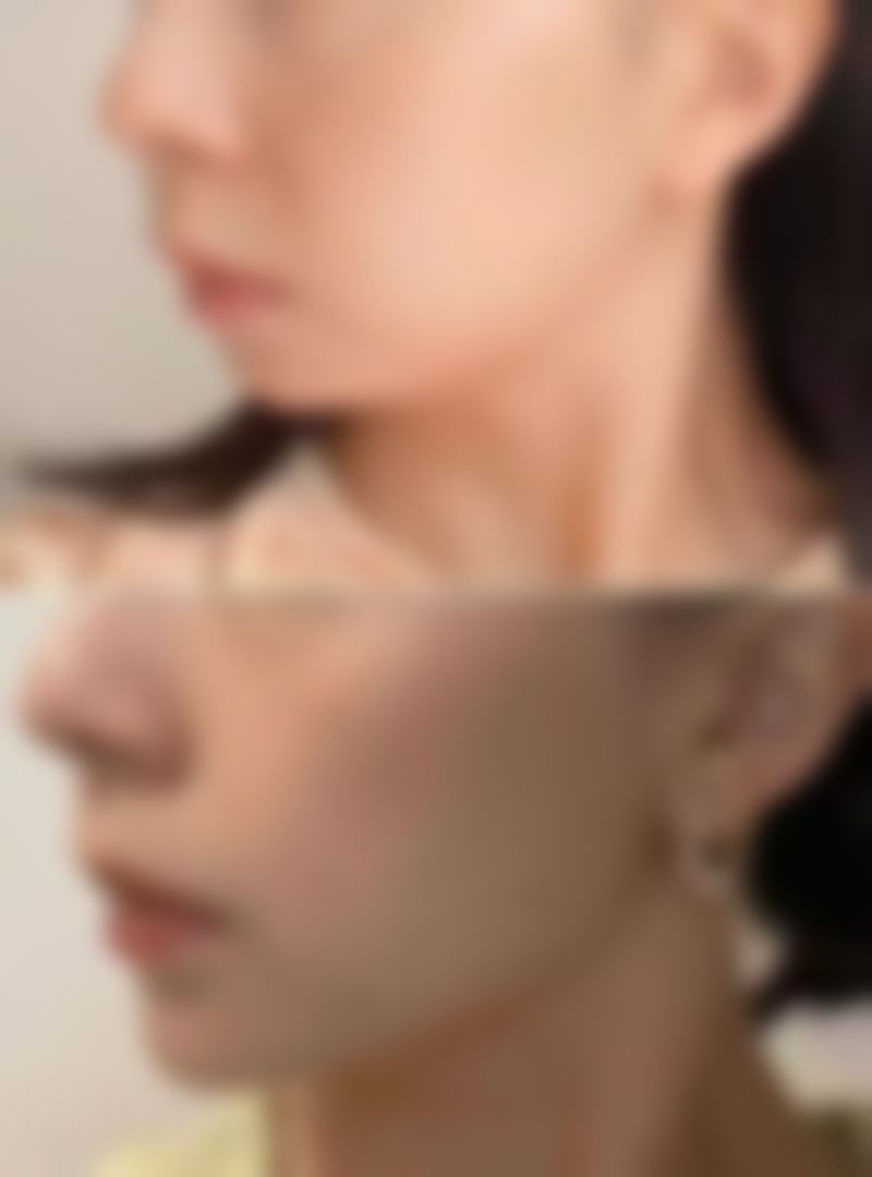 曹伟平医生的精良技术保护